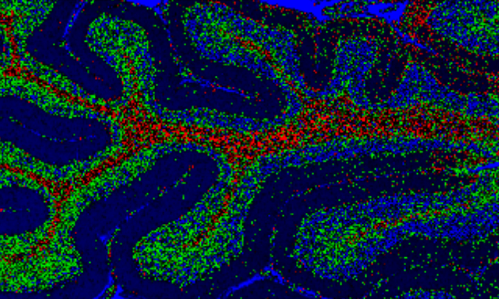 Ramanski posnetek možganskega tkiva